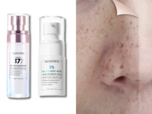 Ini 7 Rekomendasi Skincare Skintific untuk Hilangkan Flek Hitam