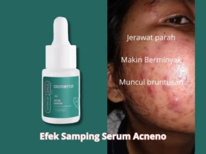 Bongkar Efek Samping Serum Acneno untuk Kulit, No.4 Sering Dibicarakan